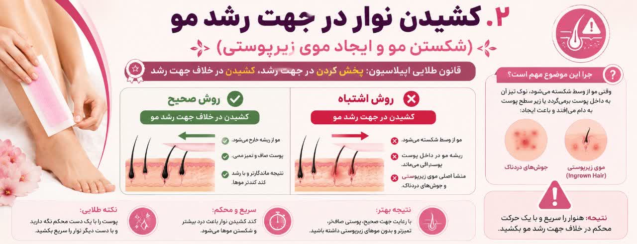 کشیدن نوار در جهت رشد مو (شکستن مو و ایجاد موی زیرپوستی)